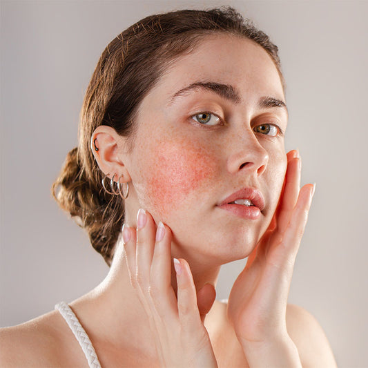 20% OFF SRA Face Pkg of 3