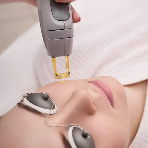 20% OFF Titan Lower Face Or Neck -Single treatment