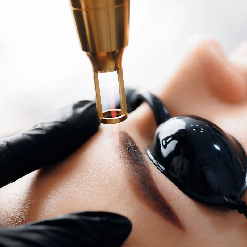 $100 OFF - Laser Genesis Face - Single Treatment